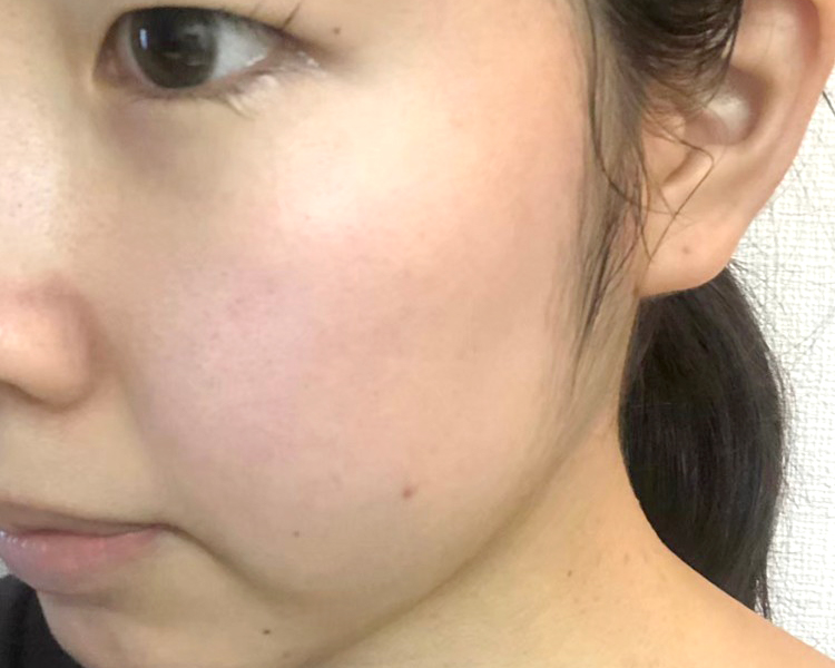 マトリックスエキス　お試し　navis 30日目②